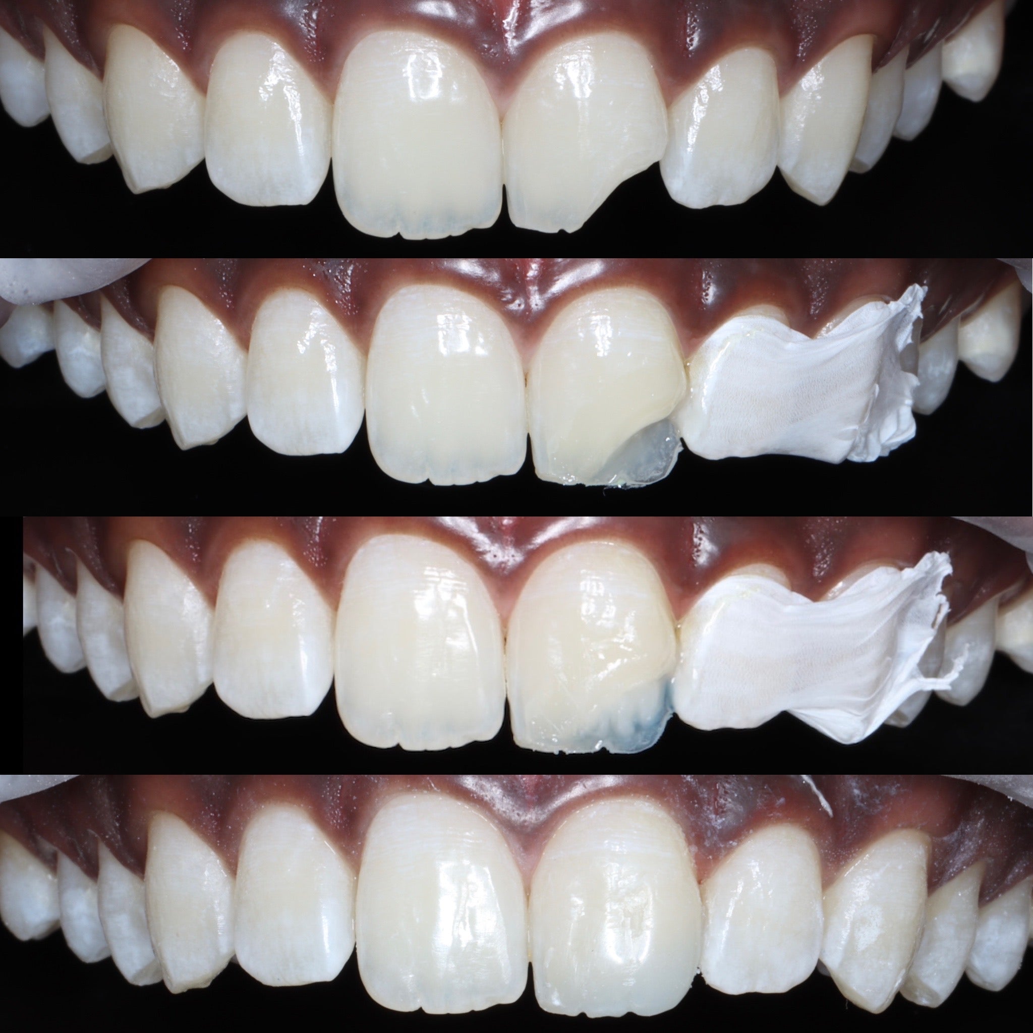 Ceramic filling result